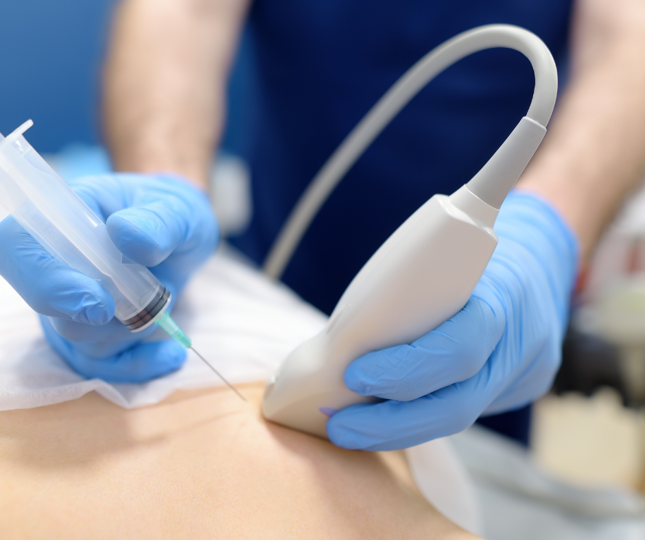 biopsie-sein-sous-echographie-aiguille