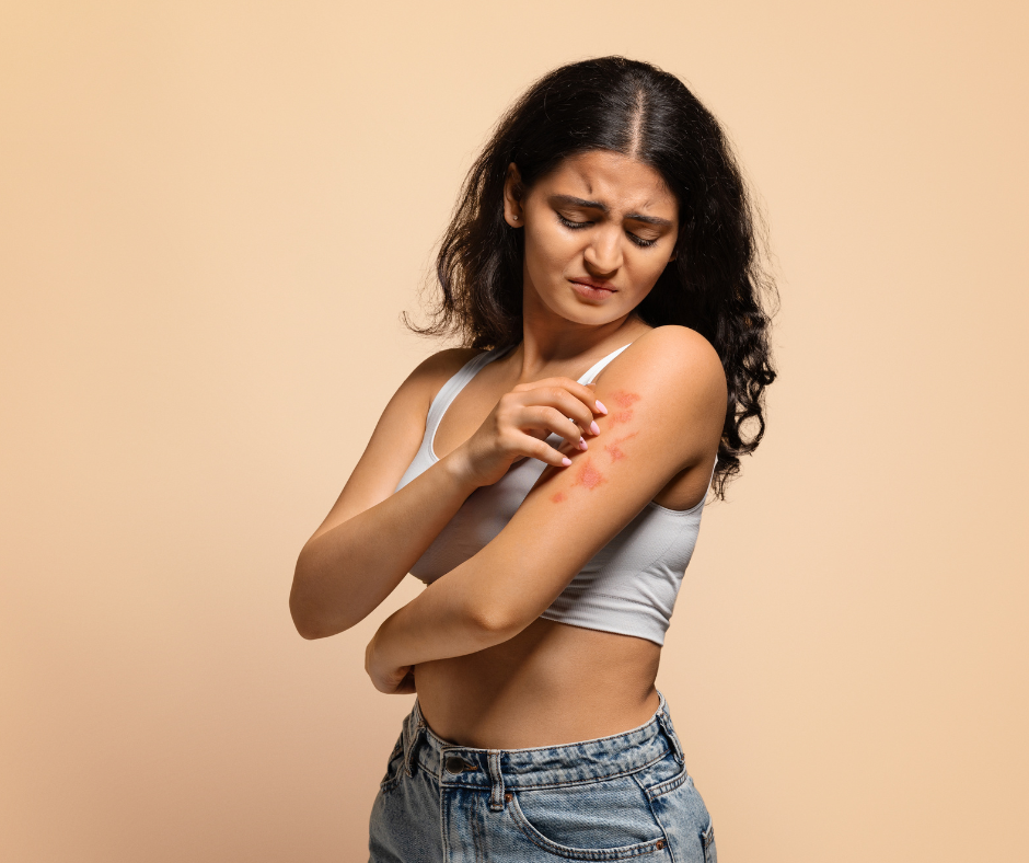 eczema-sur-le-bras