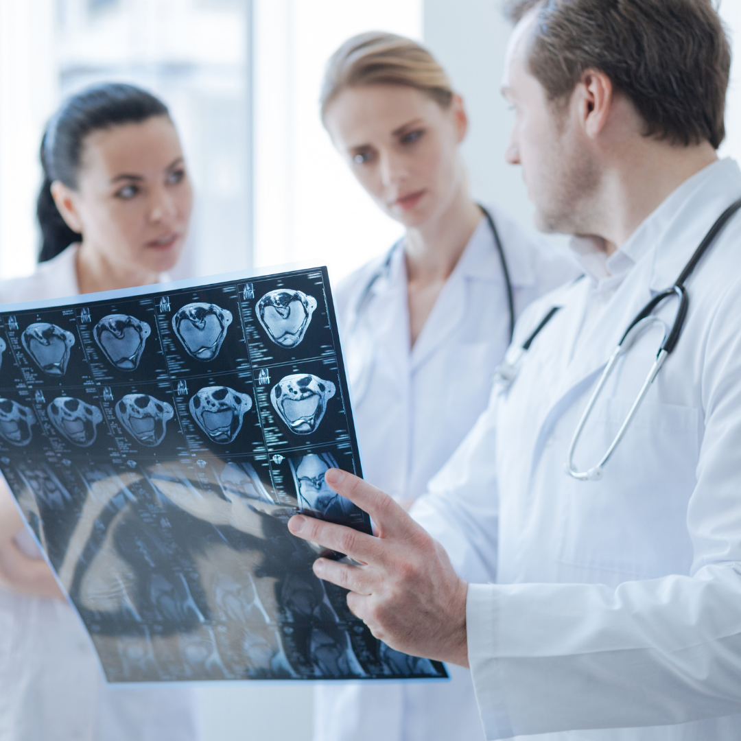 premier-signe-avc​