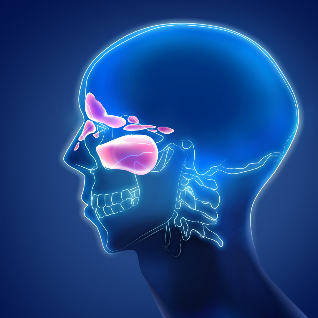 Sinusite sphénoïdale : chirurgie endoscopique et complications possibles