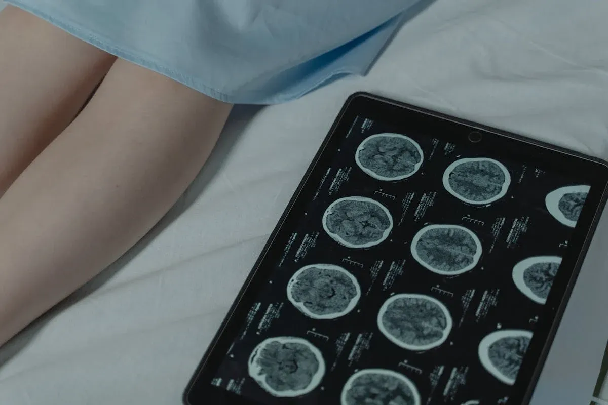 IRM cérébral : tout comprendre sur l’imagerie du cerveau
