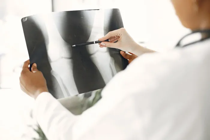 Ostéodensitométrie et arthrose : l’impact de la densité osseuse sur l’usure articulaire