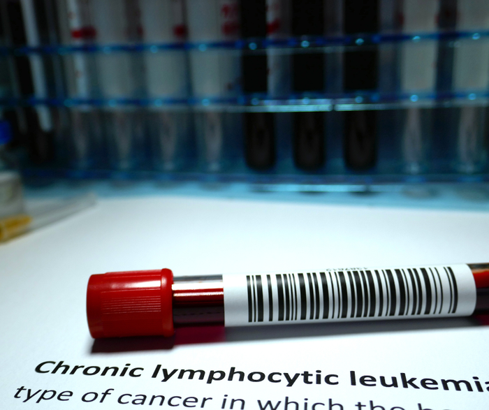 leucémie-lymphoide